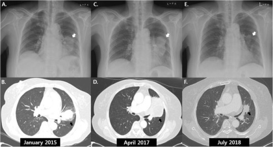 ���������� ��������: ����� ��������� �������� �� ���������� �����������