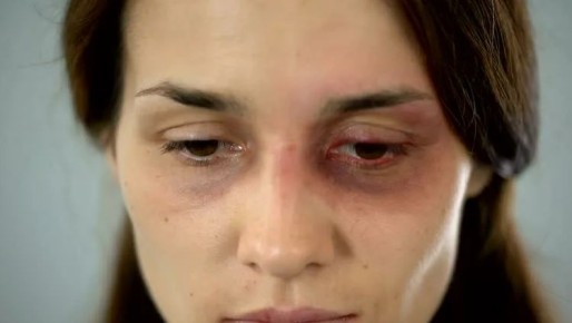 Почему некоторые хотят вернуть времена, когда мужчине было позволено поднимать руку на женщину