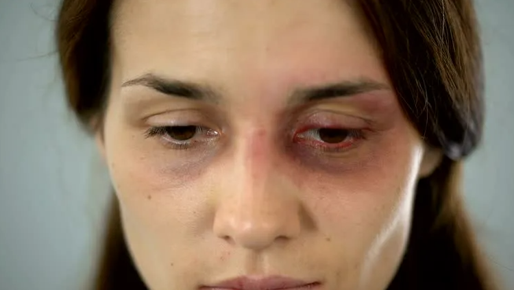 Почему некоторые хотят вернуть времена, когда мужчине было позволено поднимать руку на женщину